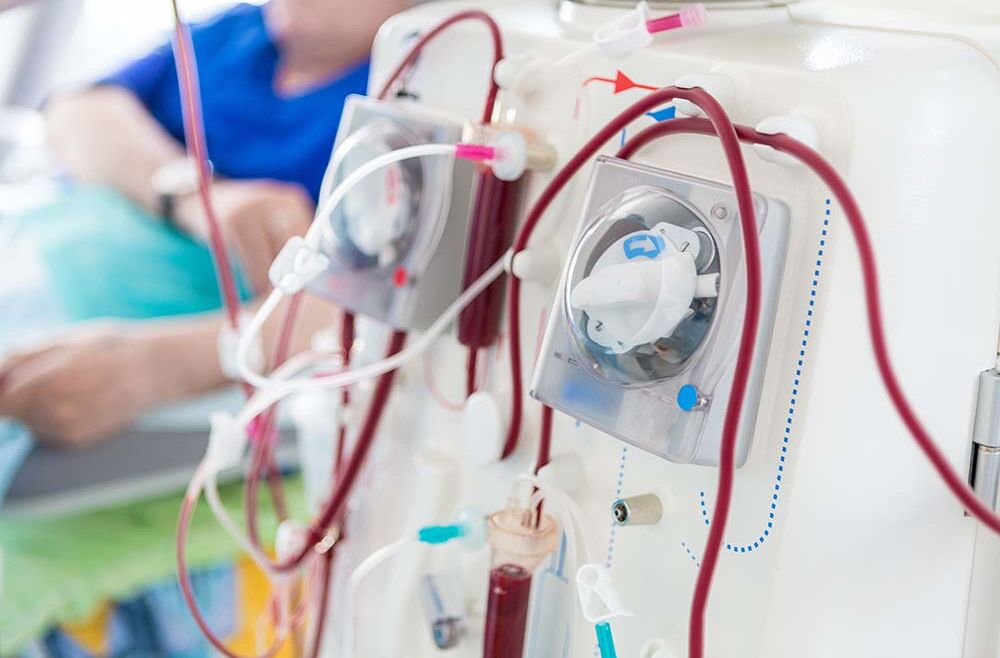 In-Patient Dialysis